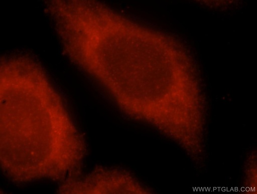 [15358-1-AP-20UL] SNUPN Polyclonal antibody