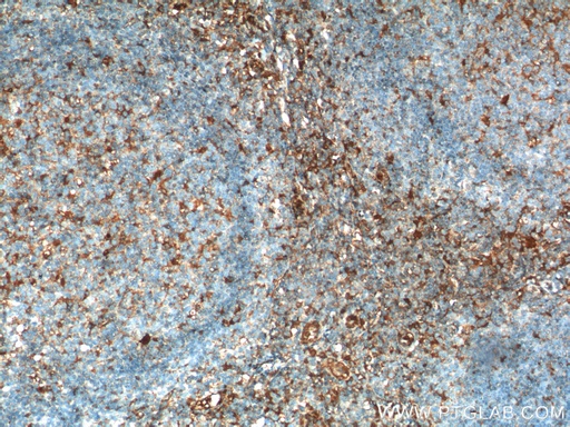 [15361-1-AP-20UL] Beta Arrestin 1 Polyclonal antibody