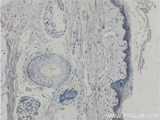 [15363-1-AP-20UL] ST6GALNAC1 Polyclonal antibody