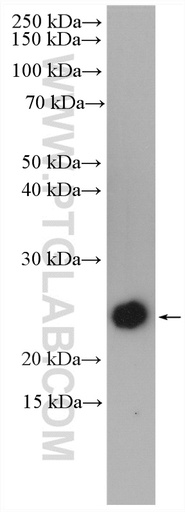 [15365-1-AP-20UL] IFN Gamma Polyclonal antibody