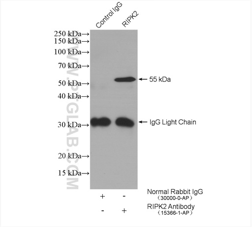 [15366-1-AP-150UL] RIPK2 Polyclonal antibody