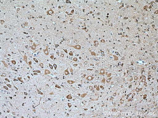[15371-1-AP-20UL] GLRB Polyclonal antibody
