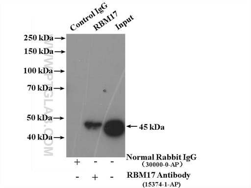 [15374-1-AP-150UL] RBM17 Polyclonal antibody