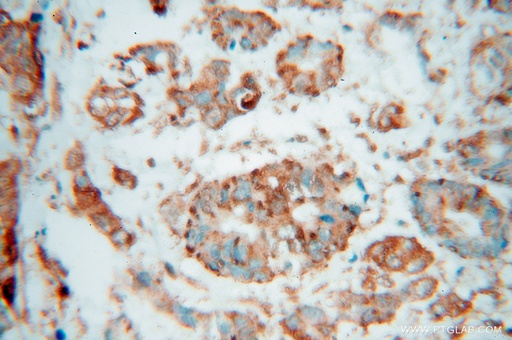 [15376-1-AP-20UL] SPTLC1 Polyclonal antibody