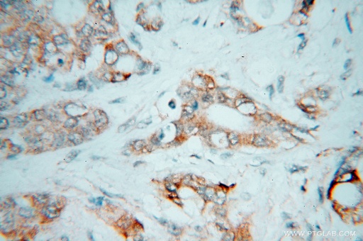 [15378-1-AP-150UL] CES2 Polyclonal antibody