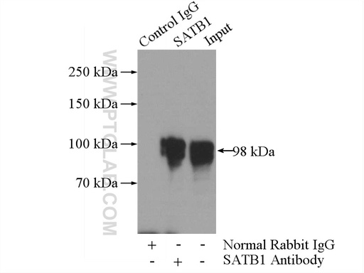 [15400-1-AP-150UL] SATB1 Polyclonal antibody