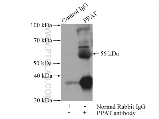 [15401-1-AP-20UL] PPAT Polyclonal antibody