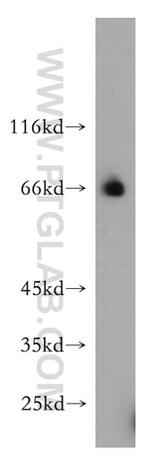 [15407-1-AP-20UL] RBM42 Polyclonal antibody