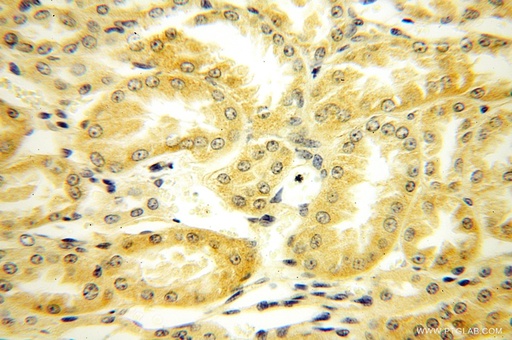 [15410-1-AP-150UL] FAPP2 Polyclonal antibody