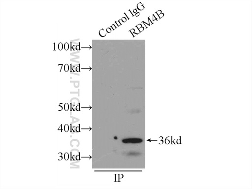 [15412-1-AP-150UL] RBM4B Polyclonal antibody