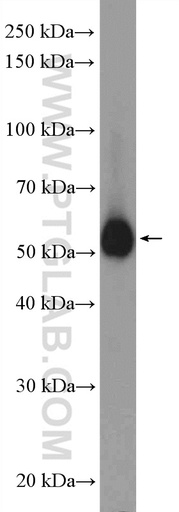 [15414-1-AP-150UL] PRPF19 Polyclonal antibody