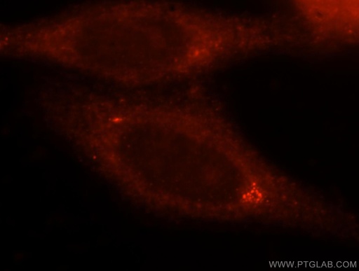 [15416-1-AP-150UL] ANXA9 Polyclonal antibody