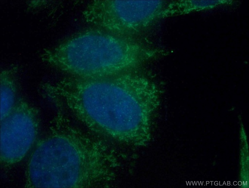 [15417-1-AP-150UL] BDH1 Polyclonal antibody