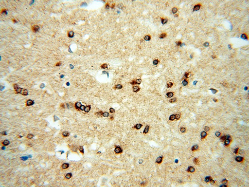 [15420-1-AP-20UL] RAB2 Polyclonal antibody