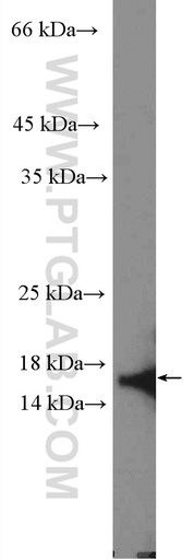 [15423-1-AP-150UL] CDK2AP2 Polyclonal antibody