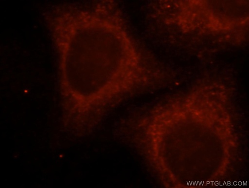 [15425-1-AP-150UL] UGT2B4 Polyclonal antibody
