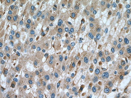 [15428-1-AP-150UL] Alpha Galactosidase A Polyclonal antibody