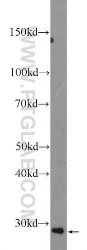 [15429-1-AP-150UL] PPT2 Polyclonal antibody