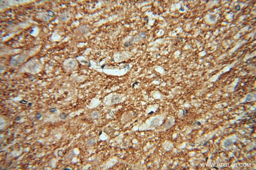 [15435-1-AP-150UL] CA11 Polyclonal antibody