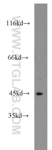[15438-1-AP-20UL] STK32B Polyclonal antibody