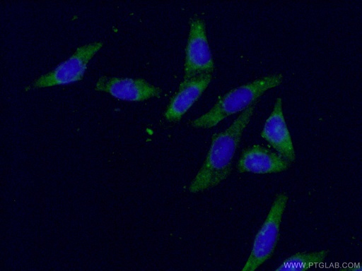 [15439-1-AP-150UL] AKR1B1 Polyclonal antibody