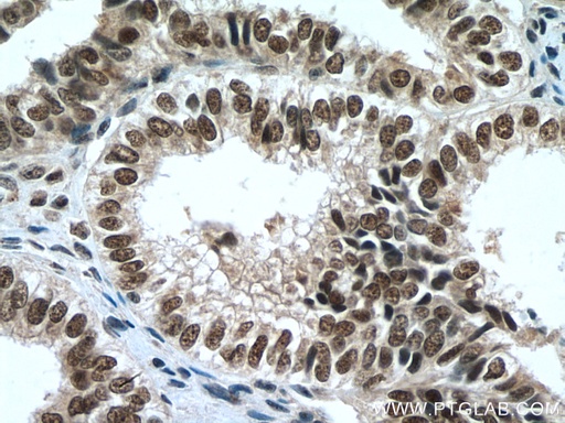[15441-1-AP-20UL] PAF1 Polyclonal antibody