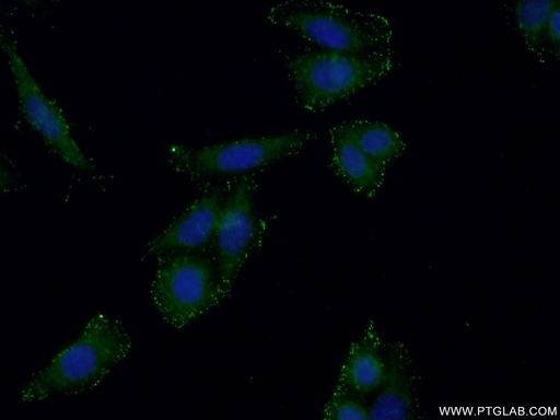 [15442-1-AP-150UL] GMDS Polyclonal antibody