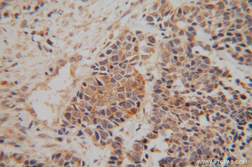 [15445-1-AP-150UL] NDUFA6 Polyclonal antibody