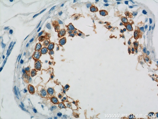 [15447-1-AP-20UL] TEX101 Polyclonal antibody
