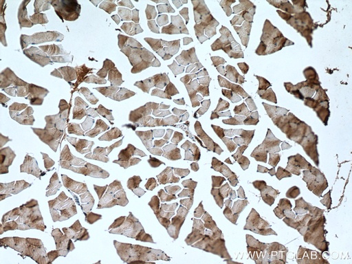[15449-1-AP-20UL] NSUN5 Polyclonal antibody