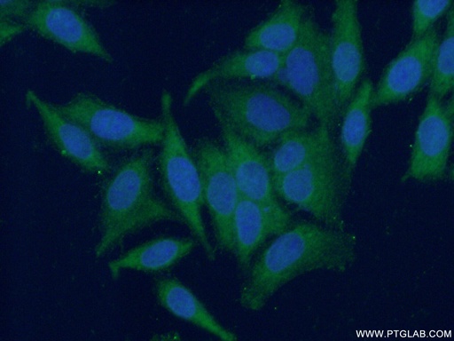 [15452-1-AP-20UL] FA2H Polyclonal antibody