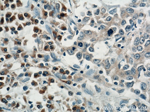 [15453-1-AP-20UL] SAR1B Polyclonal antibody