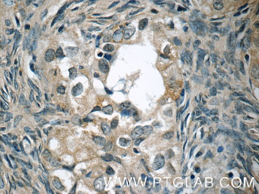 [15458-1-AP-150UL] WIT1 Polyclonal antibody