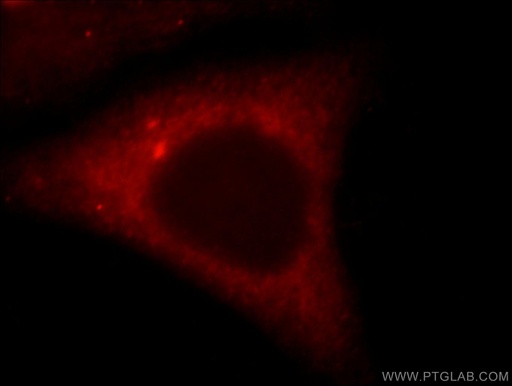 [15459-1-AP-20UL] TNIP2 Polyclonal antibody