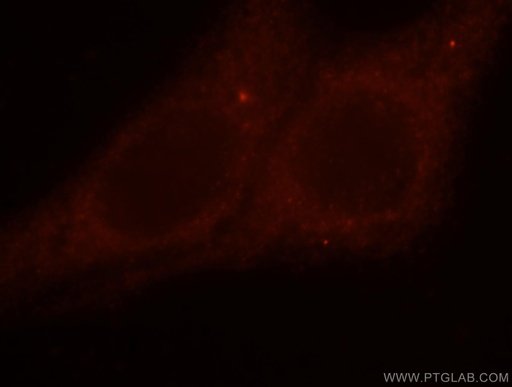 [15460-1-AP-20UL] DLC1 Polyclonal antibody