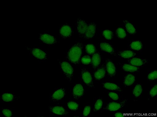 [15461-1-AP-20UL] RPP25 Polyclonal antibody