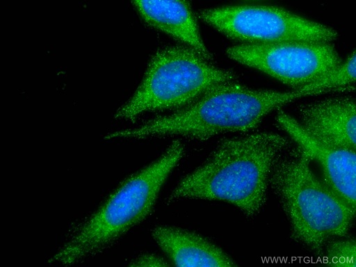 [15463-1-AP-150UL] MAPKAP1 Polyclonal antibody