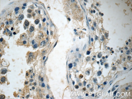 [15470-1-AP-20UL] ALKBH7 Polyclonal antibody