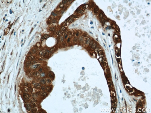 [15471-1-AP-150UL] LIMD2 Polyclonal antibody