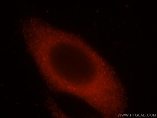 [15472-1-AP-150UL] VPS24 Polyclonal antibody