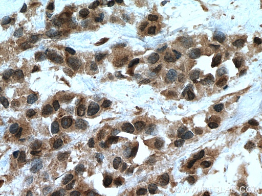 [15475-1-AP-20UL] UBE2D1/2/3/4 Polyclonal antibody