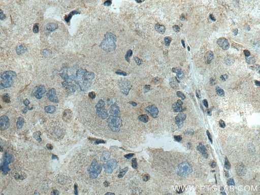 [15477-1-AP-20UL] ADK Polyclonal antibody