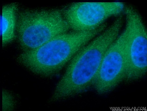 [15478-1-AP-20UL] VPS28 Polyclonal antibody