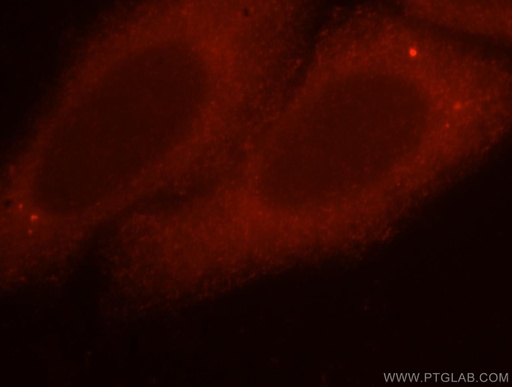 [15479-1-AP-150UL] UNC45A Polyclonal antibody