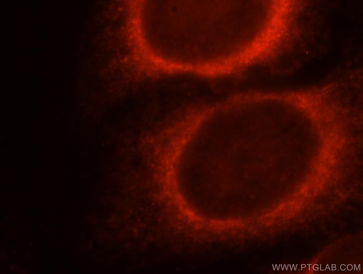 [15484-1-AP-150UL] DNAJB11 Polyclonal antibody