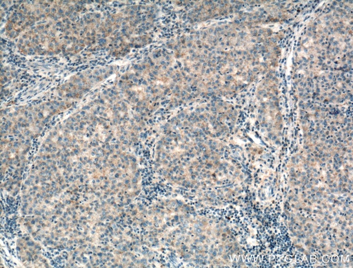 [15485-1-AP-20UL] RAB31 Polyclonal antibody