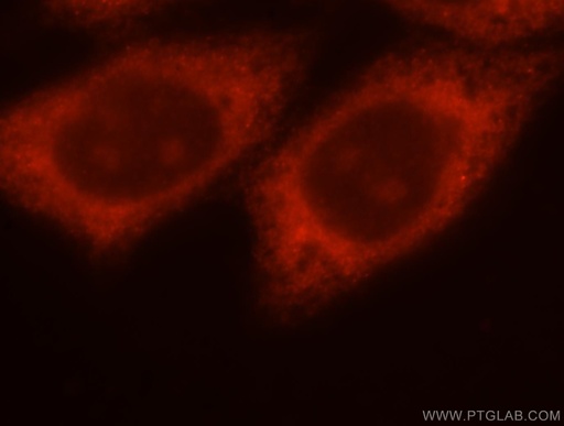 [15486-1-AP-20UL] THTPA Polyclonal antibody