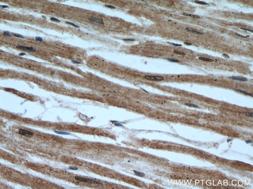 [15488-1-AP-150UL] UBE2E3 Polyclonal antibody