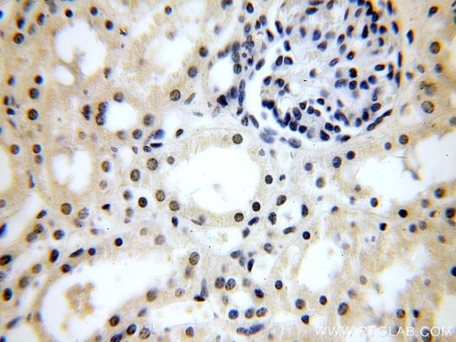 [15489-1-AP-20UL] CPSF6 Polyclonal antibody
