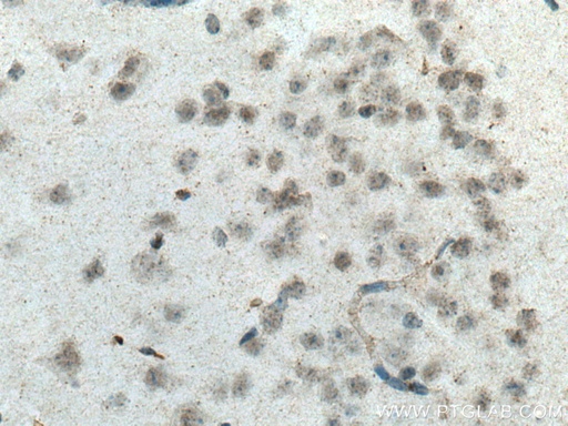 [15490-1-AP-150UL] SCNM1 Polyclonal antibody
